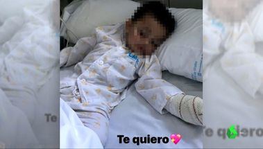 Un Pitbull muerde a un niño de 19 meses que paseaba con su familia por Alpedrete