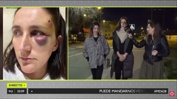 Una joven que se lesionó en una acera de Collado Villalba tras tropezar con una baldosa en mal estado, denunciará al Ayuntamiento