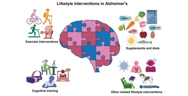 Investigación revela beneficios de estilo de vida en el manejo del Alzheimer