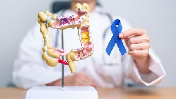 Madrid alcanza récord histórico en pruebas de detección de cáncer de colon con 357,000 participantes